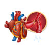 Heart Disorder